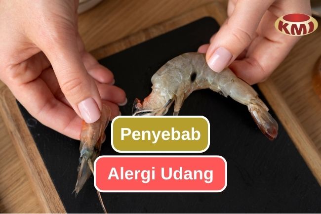 Yuk Simak Bagaimana Terjadinya Alergi pada Udang